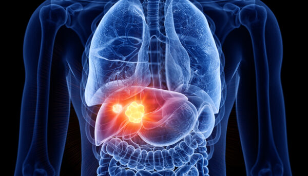HEPATIC REGENERARE - 200 ml - Image 2